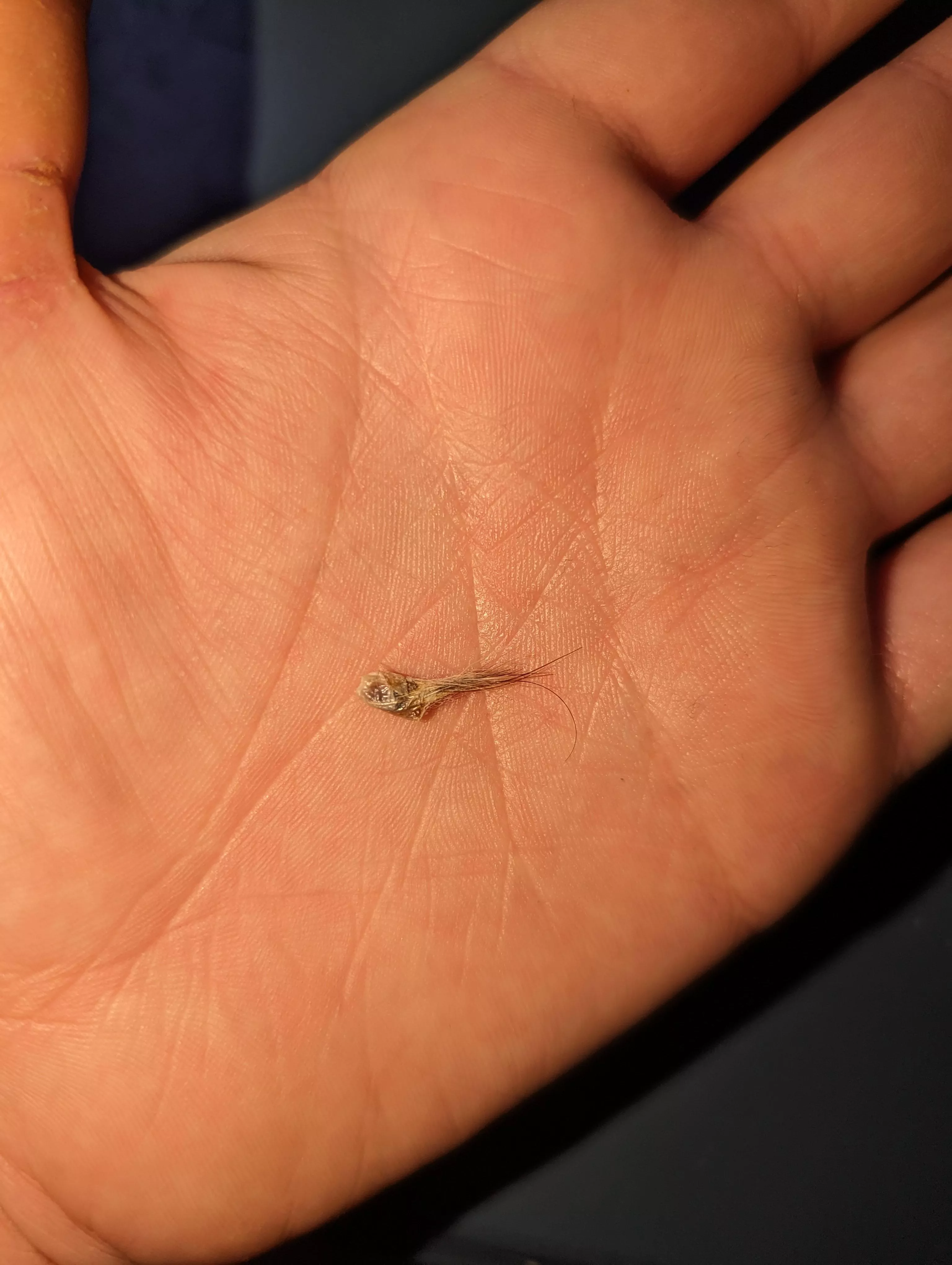 Just learned that navel stones are a thing after pulling this guy out of my bellybutton. posted by Ishtarthedestroyer