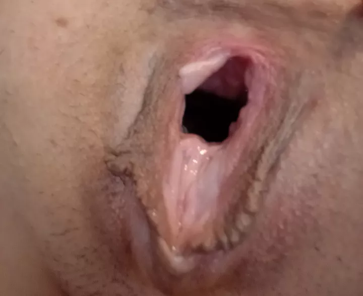 Love holding myself open like this posted by PsychologicalSwim780