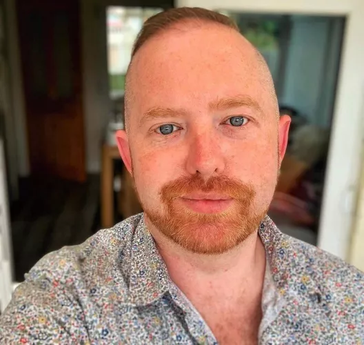 My Freckles use to be my insecurity. Now I just have to admit and own. I think it makes me cute by __unplug