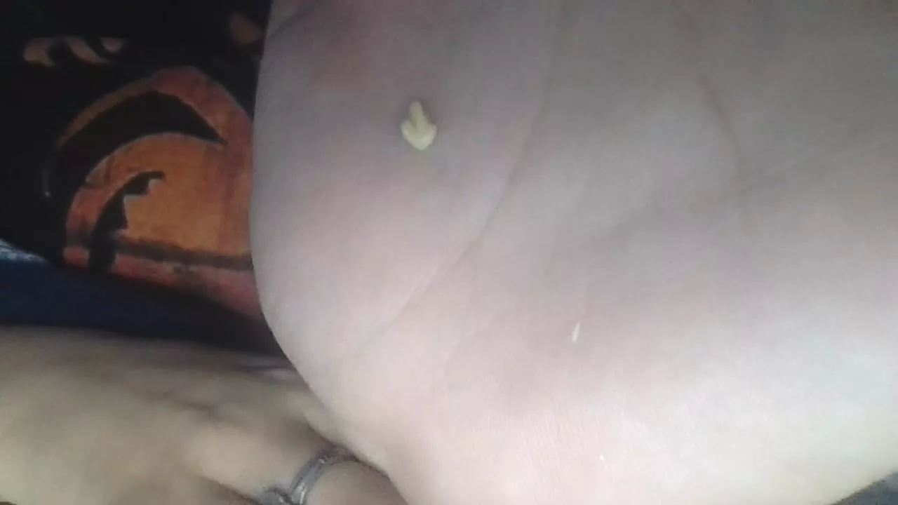 This really gnarly tonsil stone just popped out posted by Shadow-Floof