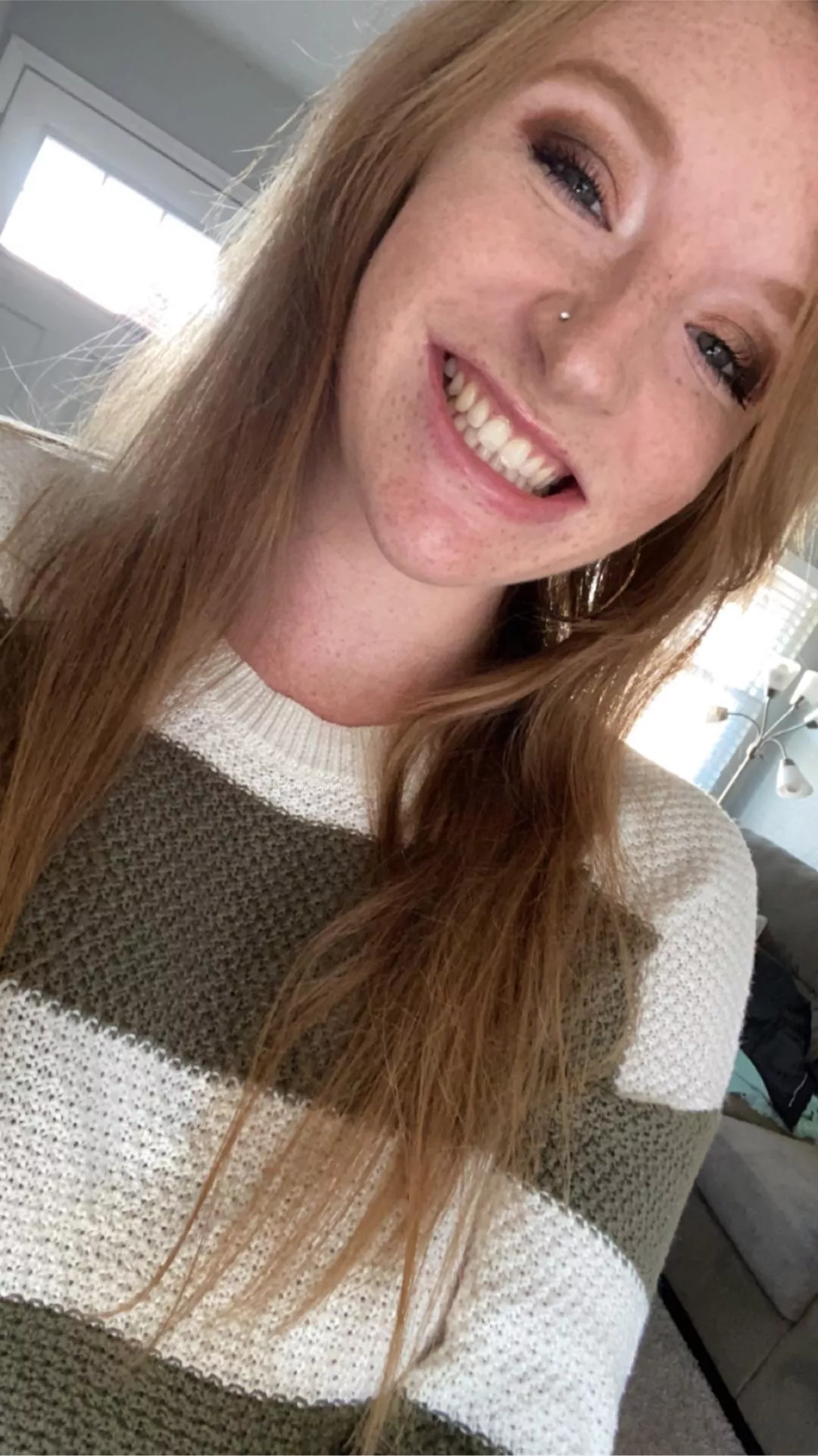 Do you really like freckles posted by Nervous_Wrongdoer_82