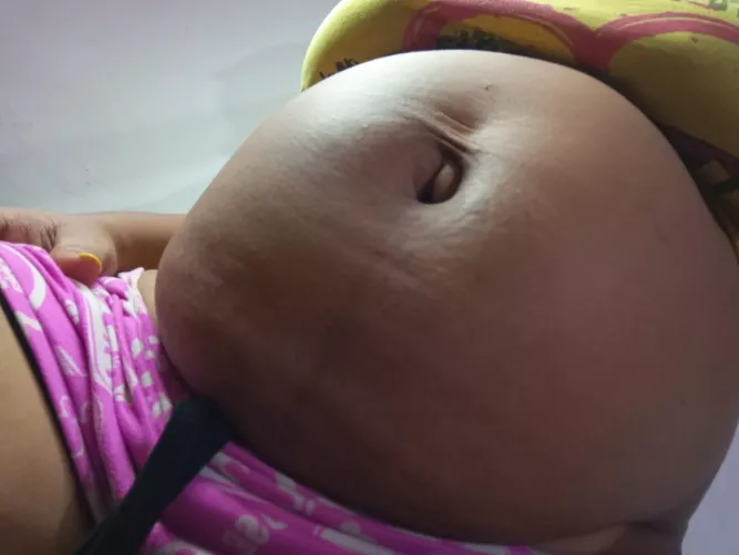 I'm going to explode 🤰🐷 by Any-Second-7668