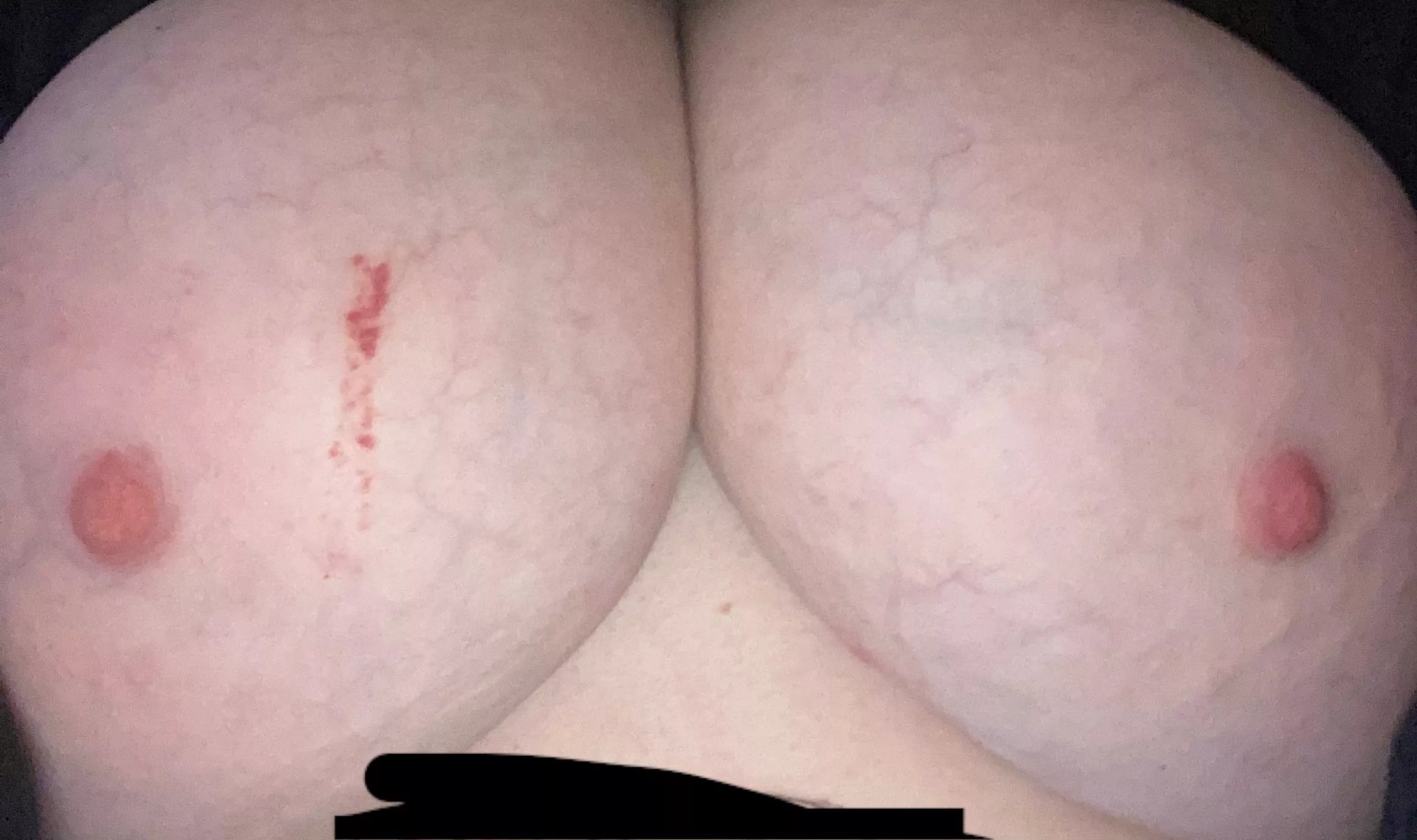 Hi! F28 posted by Early-Pumpkin2197