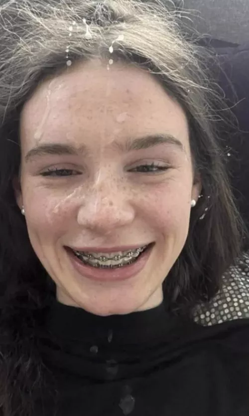 The Braces Need A Load Or Two by KingKaneWood