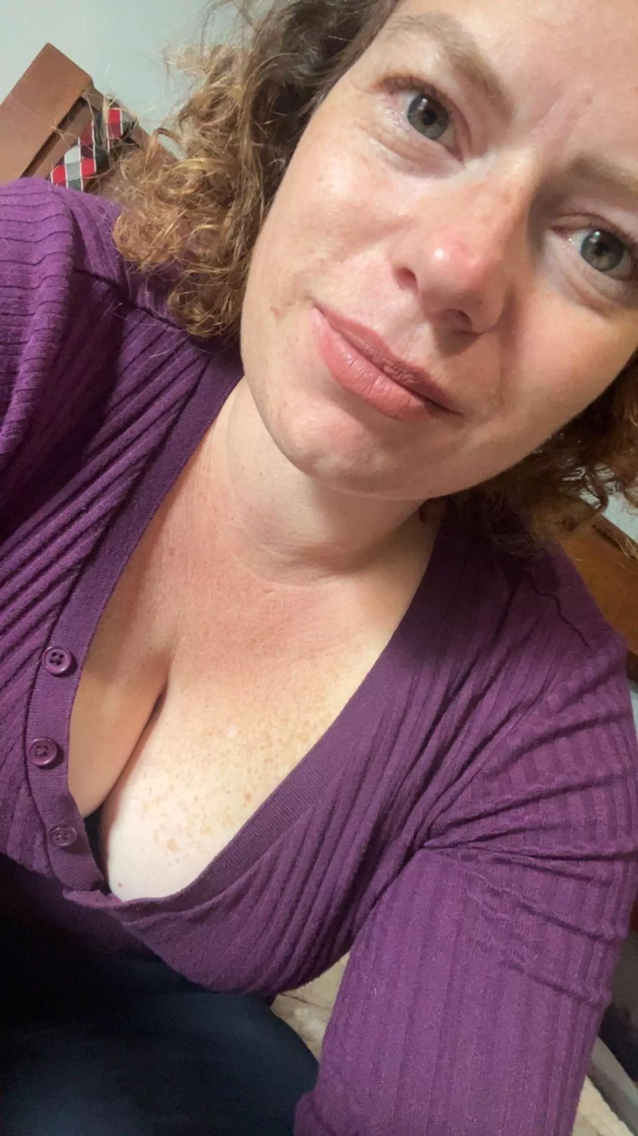 My buttons came loose again! posted by Unlimited_mango