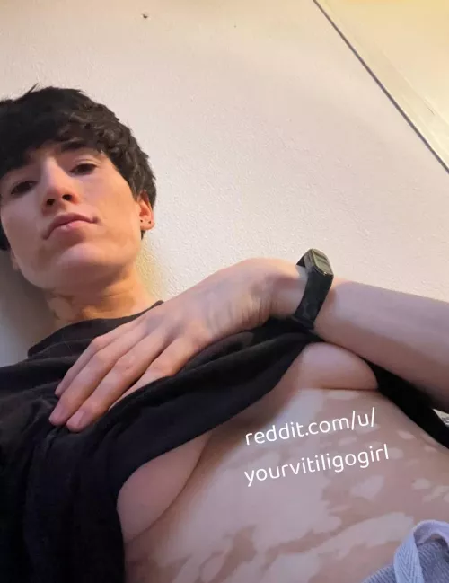 Enjoy my underboobs by yourvitiligogirl