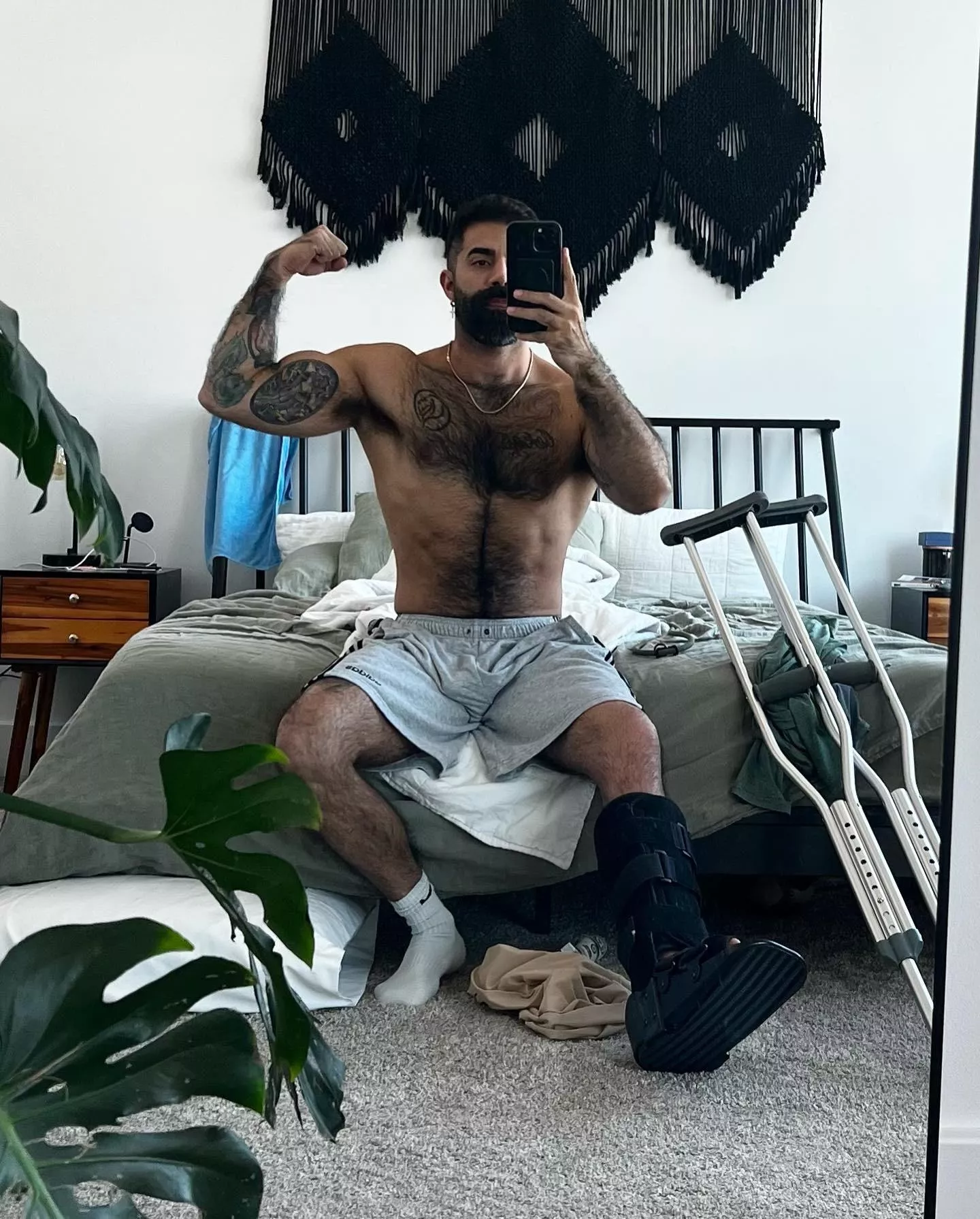 Alpha pits, broken leg or not posted by MooseDaddy999