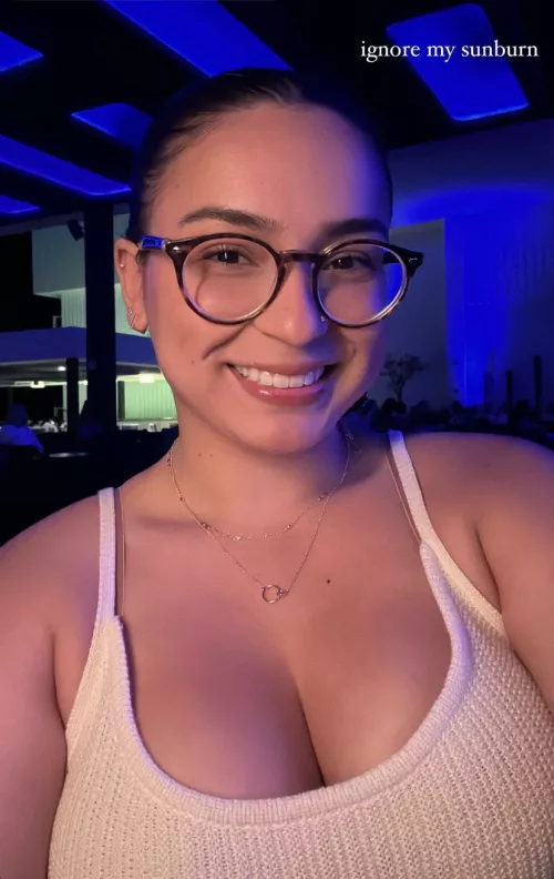 Ignore my sunburn by LayDownYourBurdens