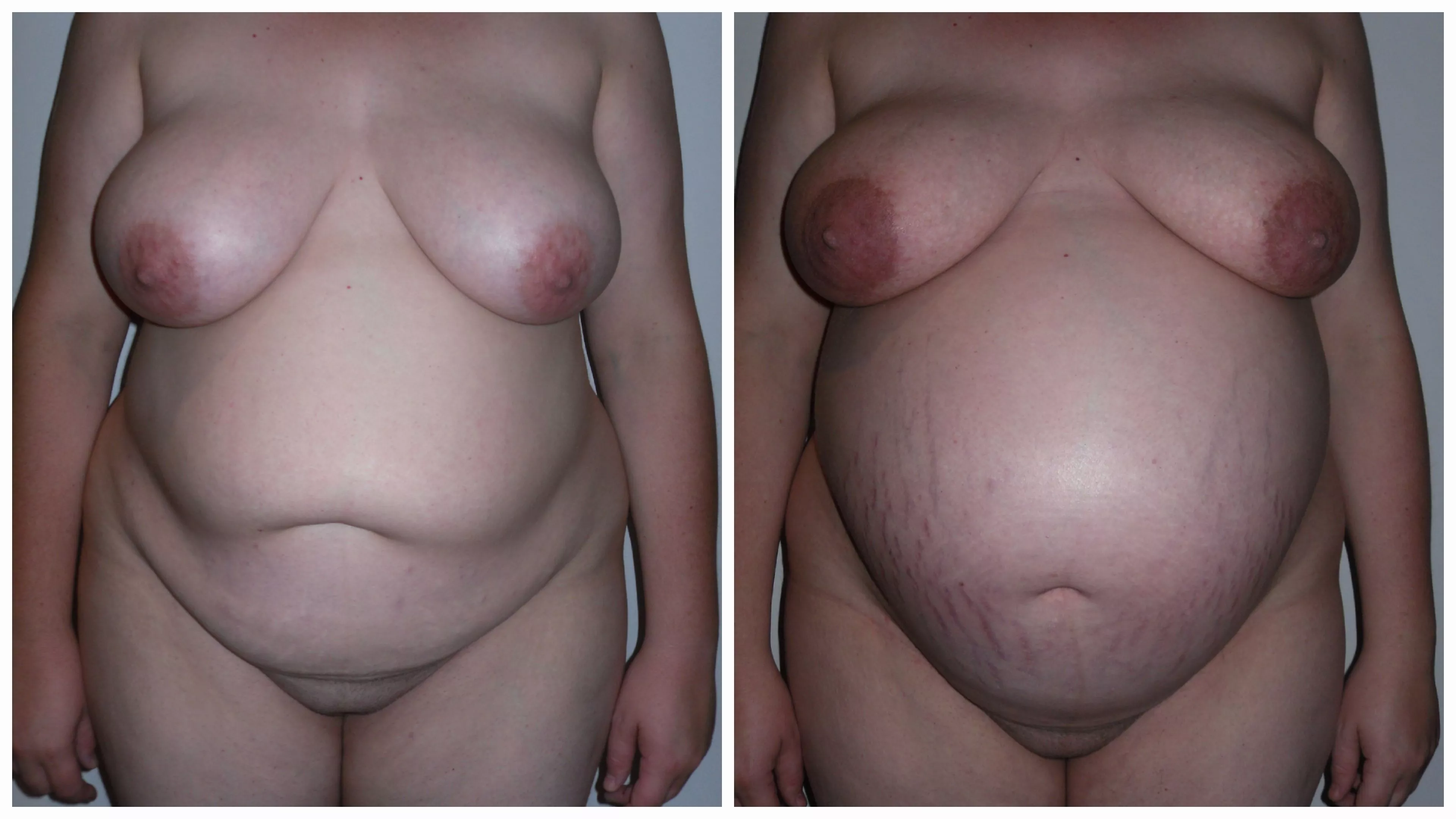 3 months or so vs ready to pop! posted by hnyauscpl81