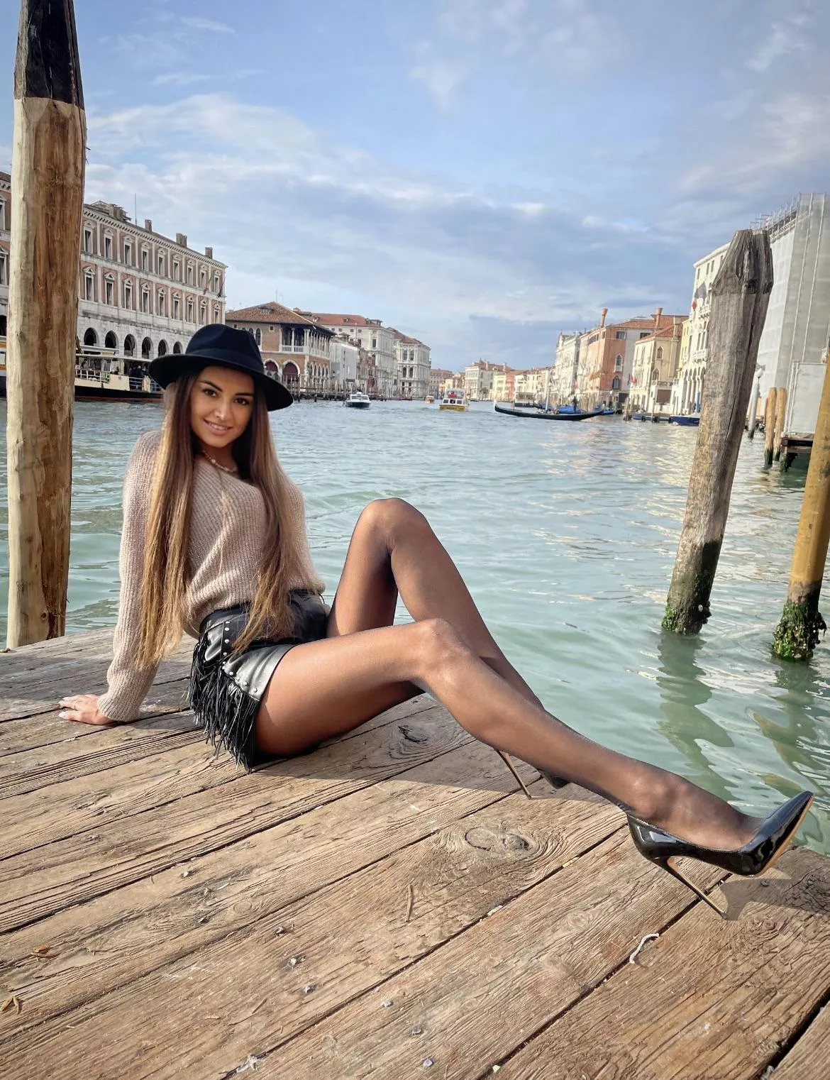 My legs are my privilege posted by Tamara-Sunshine