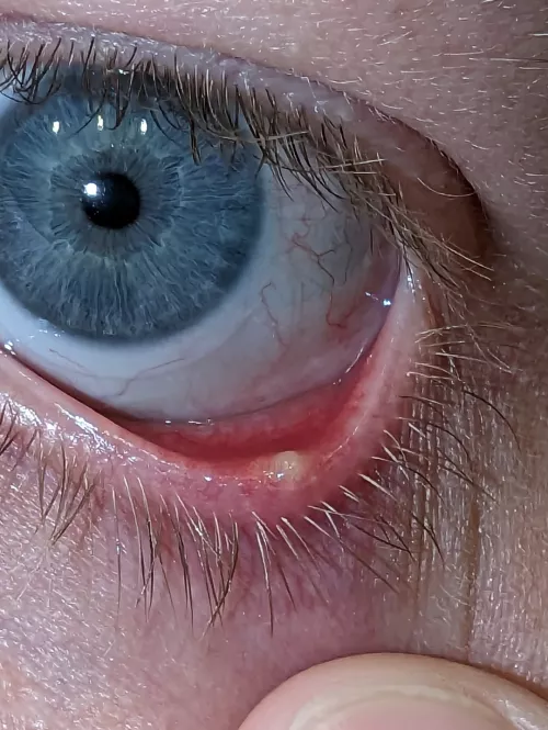 The Internet tells me not to do it....but damn do I want to. by namecannotbeblankk