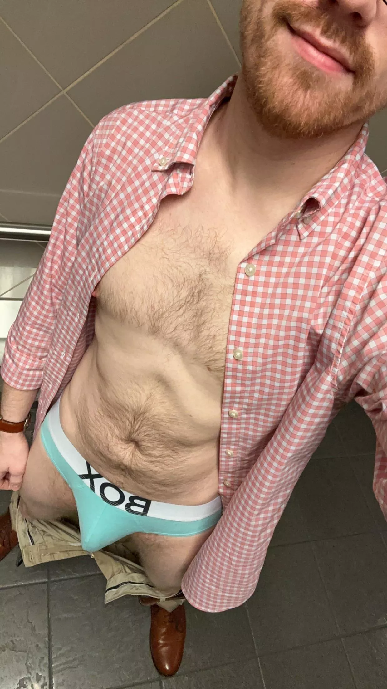 All the buttons keep coming undone posted by Bromotexual