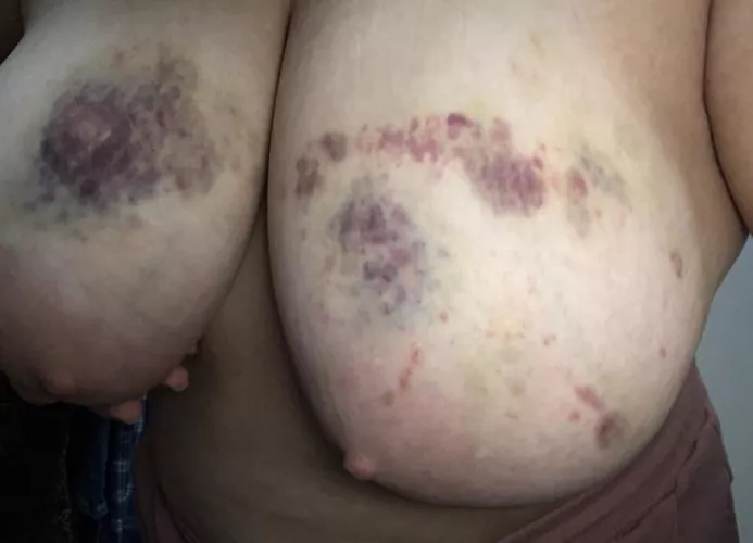 Tie me down and destroy all my virgin holes. I need the pain, and I can take worse than this by Efficient_Slut2001