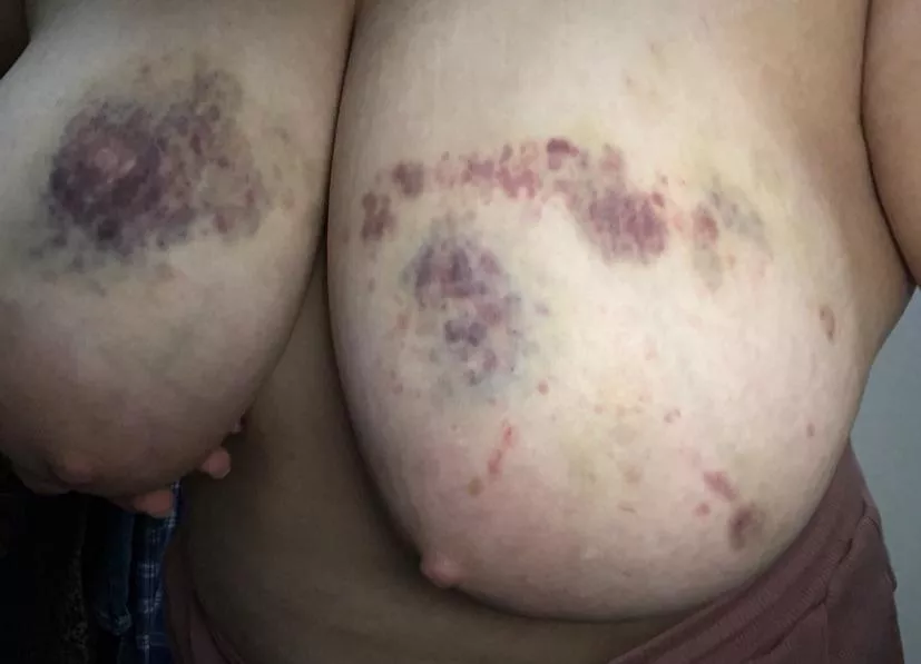 Tie me down and destroy all my virgin holes. I need the pain, and I can take worse than this posted by Efficient_Slut2001