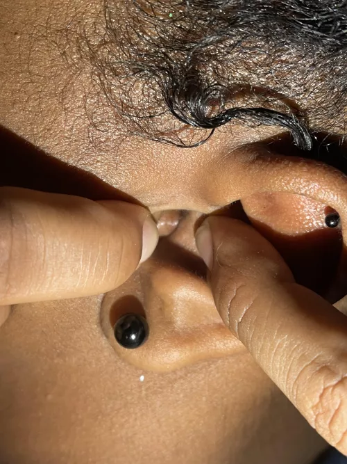 Difficult ear pop potential by Skincareanonacct