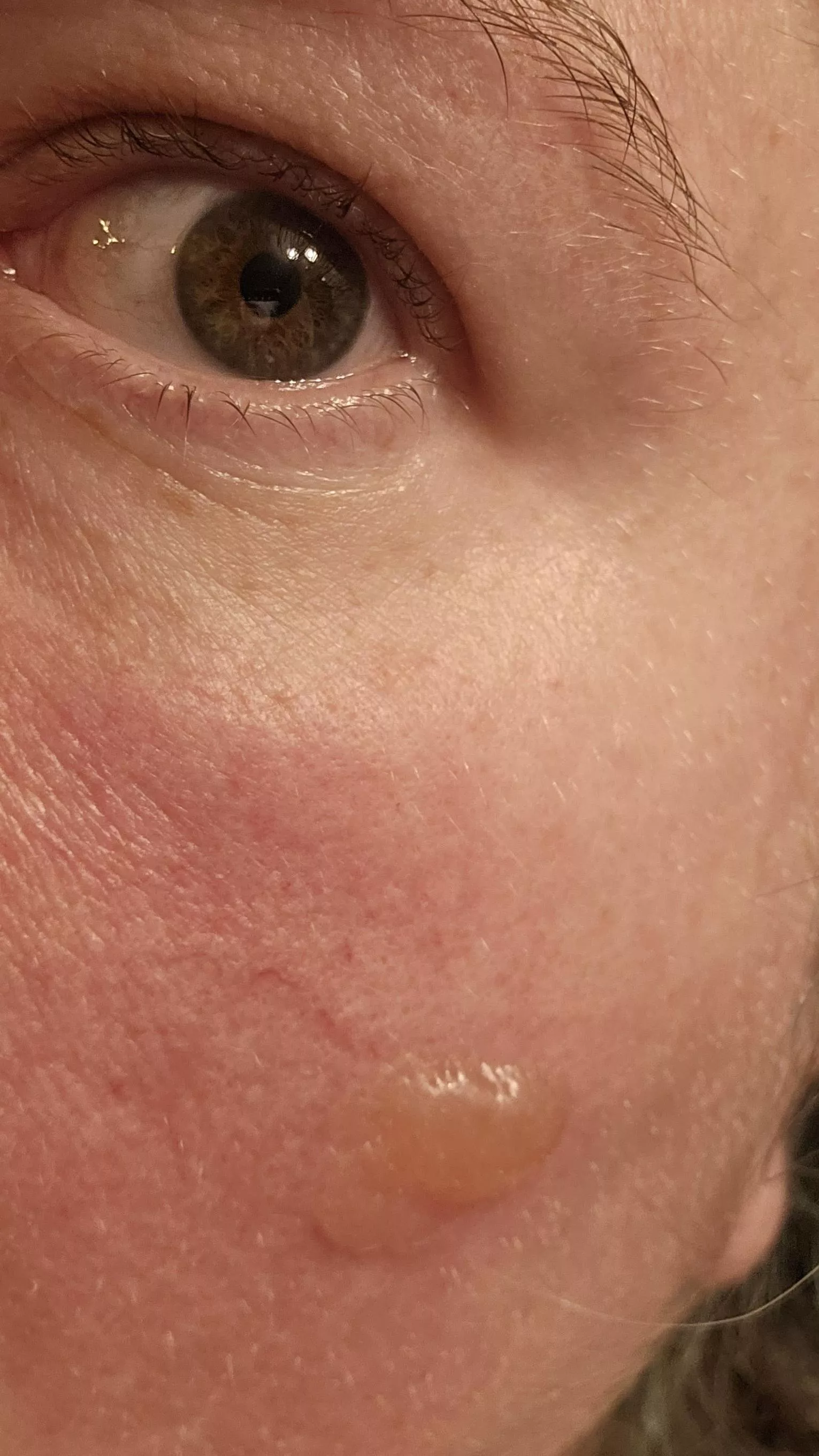 Forbidden face bubble posted by Rhymes_with_Demon