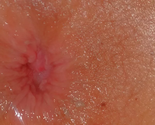 Anal stretch by sezyken11