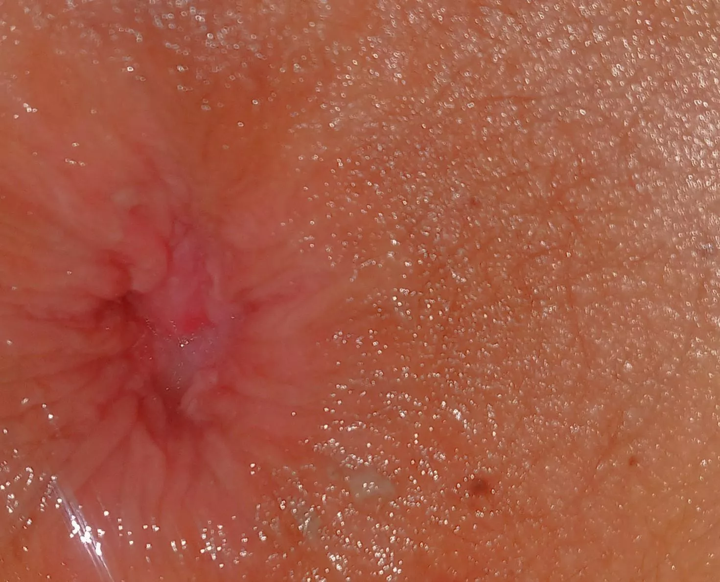 Anal stretch posted by sezyken11