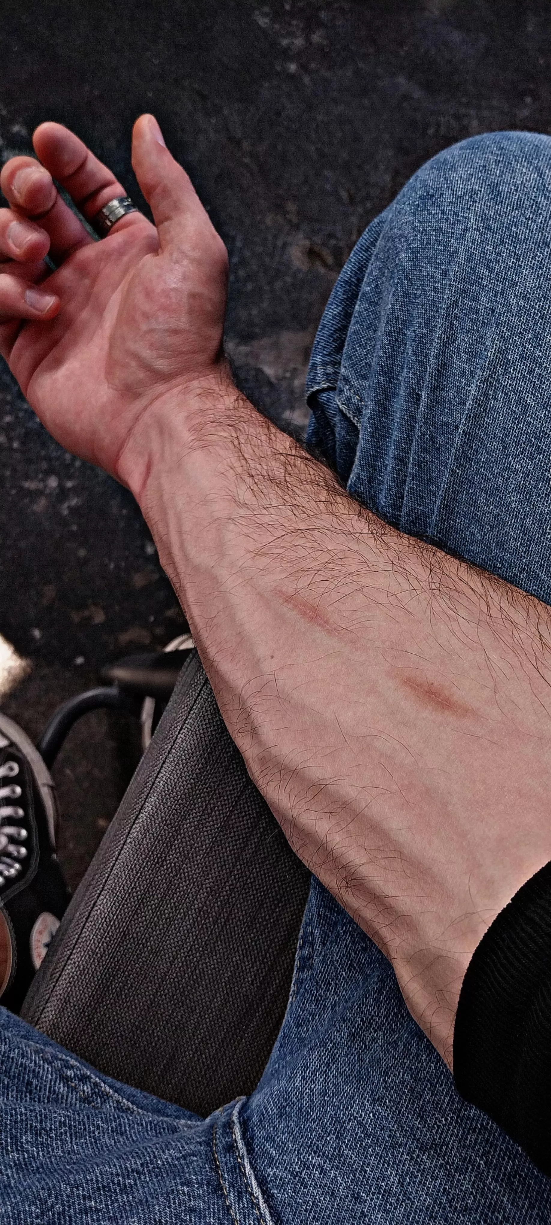 F o r e a r m posted by DrEcstasy