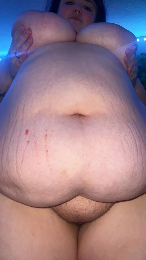 the stretch marks just keep going up 😩 by littlesam56
