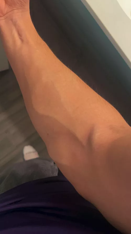 Nurses love me💉😂 by No-Orchid-486