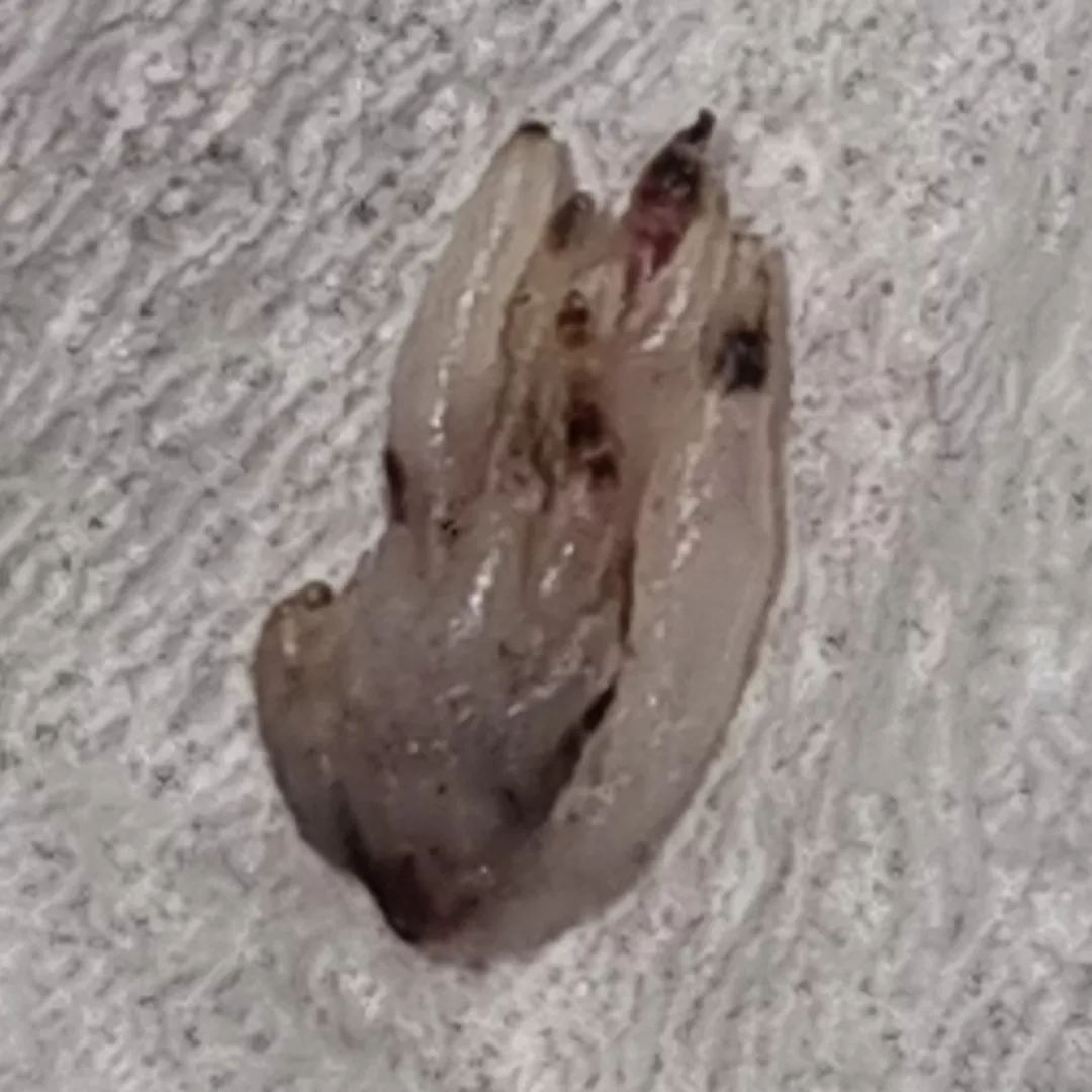 Removed a family of ingrown hairs from my dog posted by suicinivtf