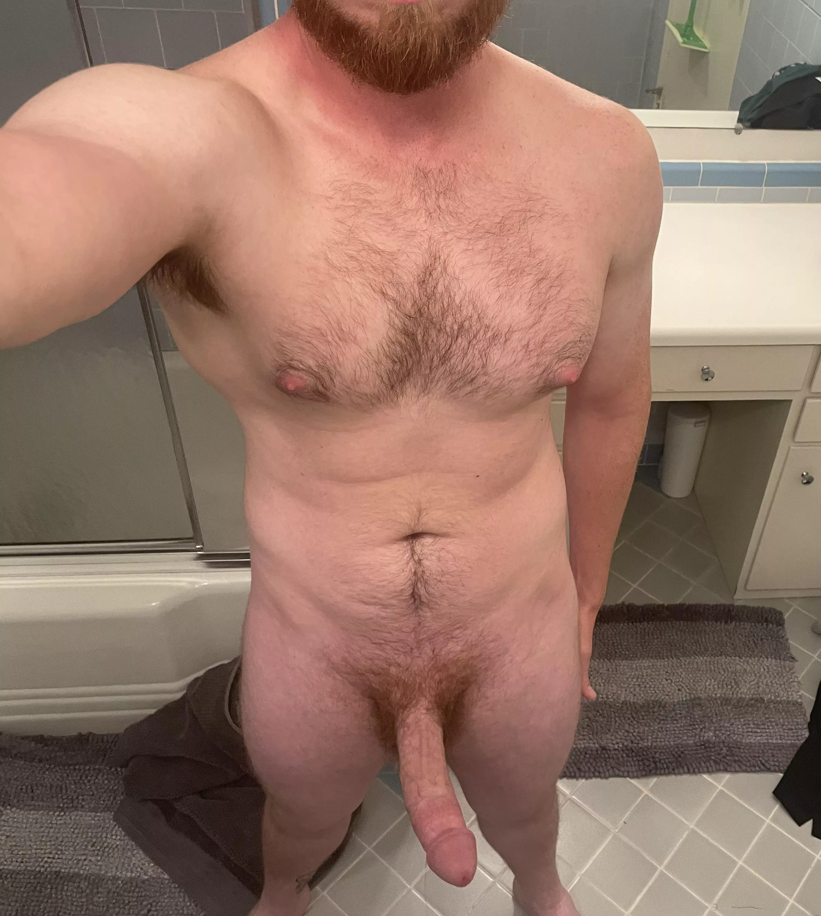 Sunburned 😭 posted by BayAreaBanksy