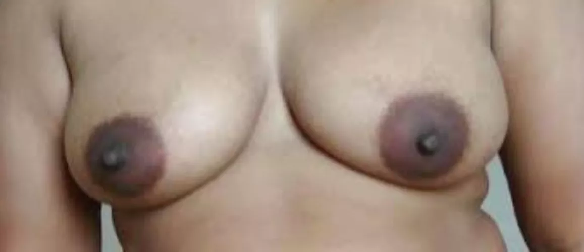 setting them freeee by fun_das123