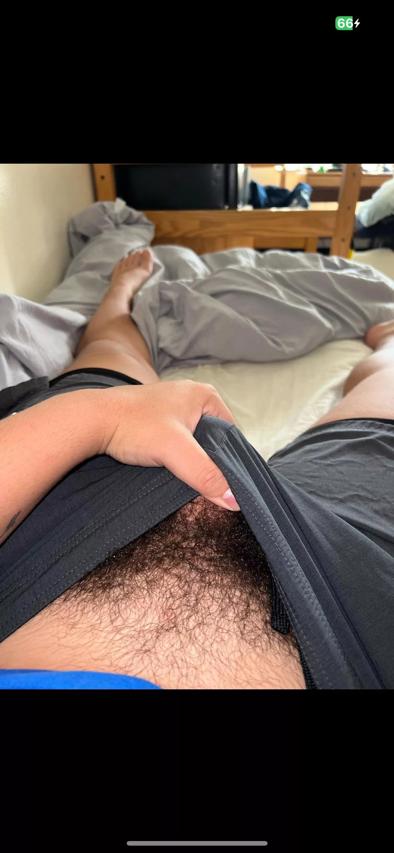 (18) Someone told me to shave it should I listen?? posted by South-Battle-7561