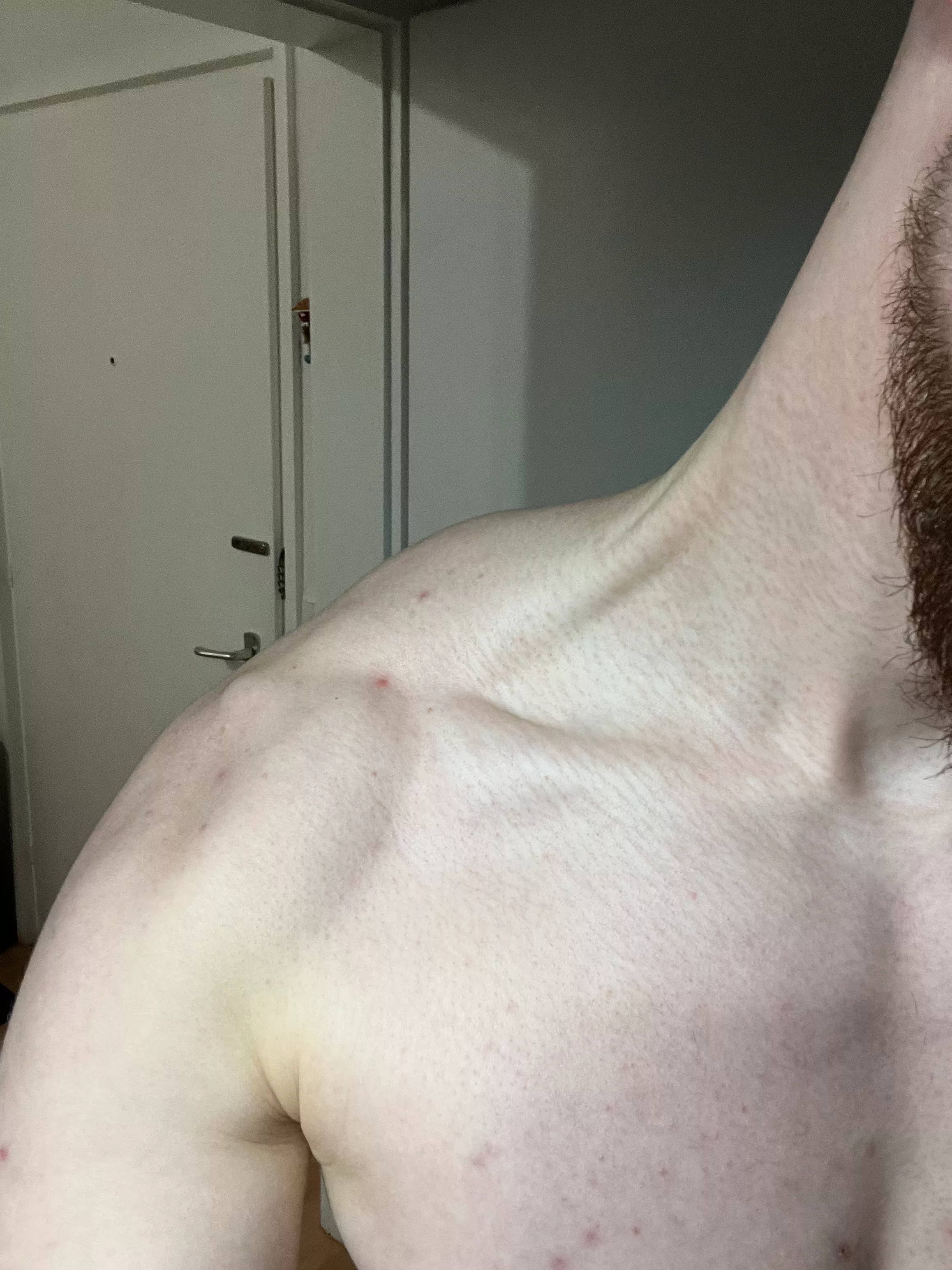 big neck posted by KeyDisance