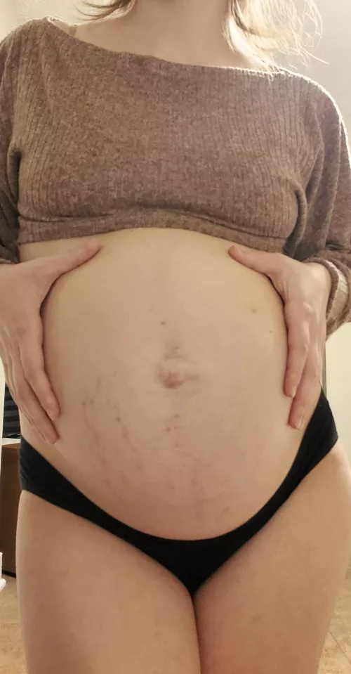 5th pregnancy with my stretchmarks. Would you agree stretchmarks are sexy? by pixieizzi