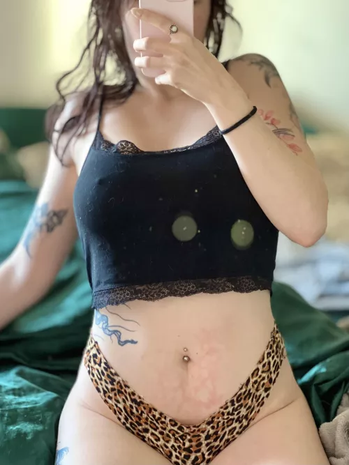 Woke up with an interesting water bottle burn mark [f] by CandideCrush