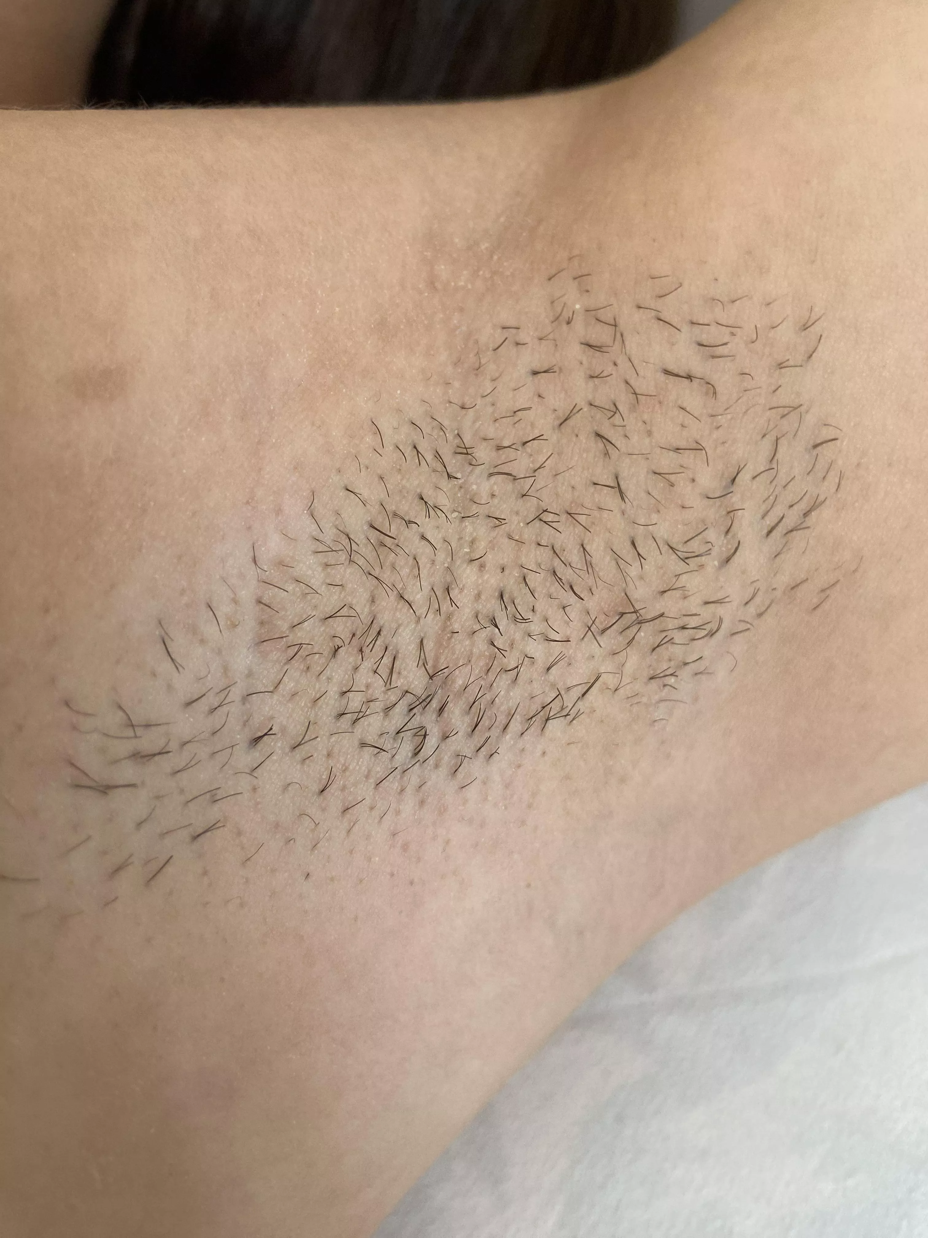 My closeup stubble pit posted by cuttie_kitty