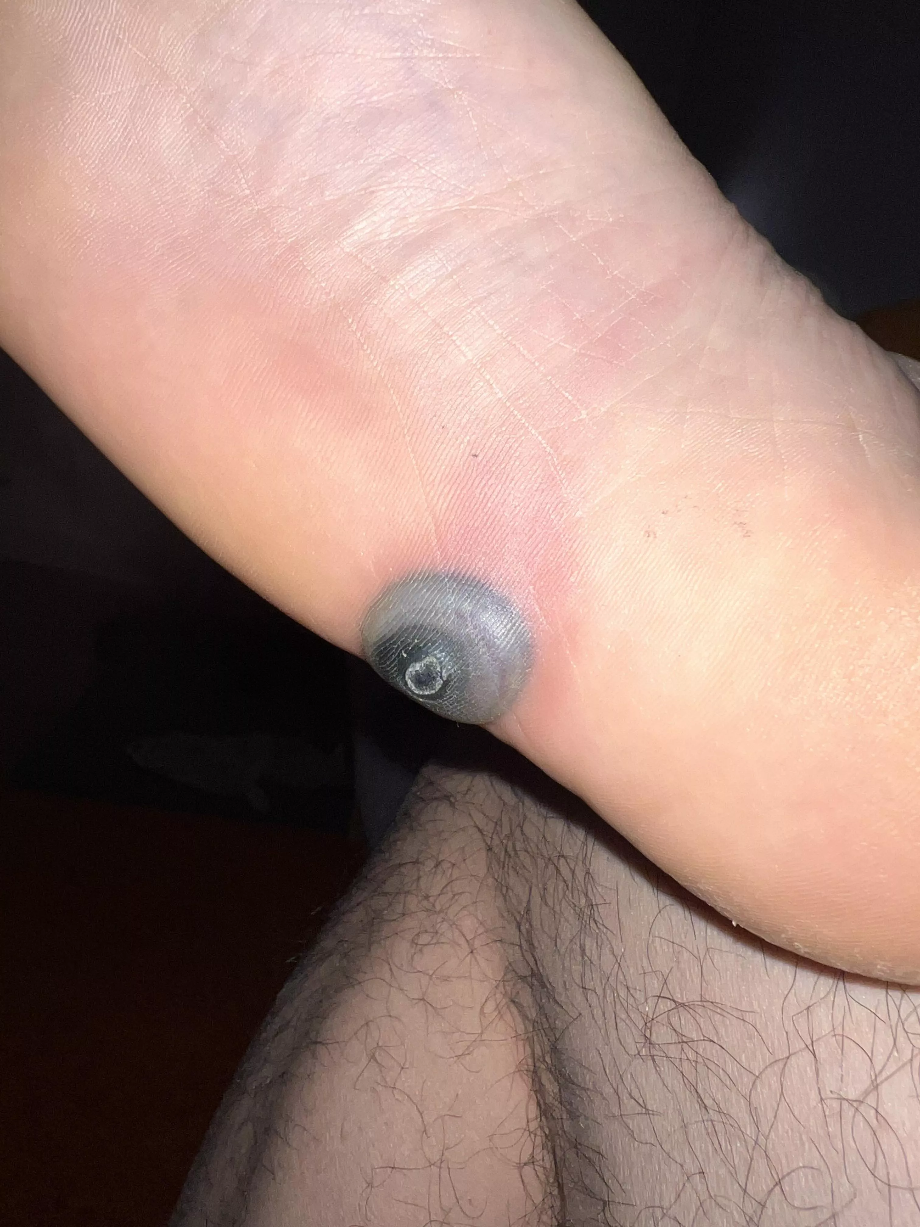 Really wish I can f**king pop this posted by SlashPiggie