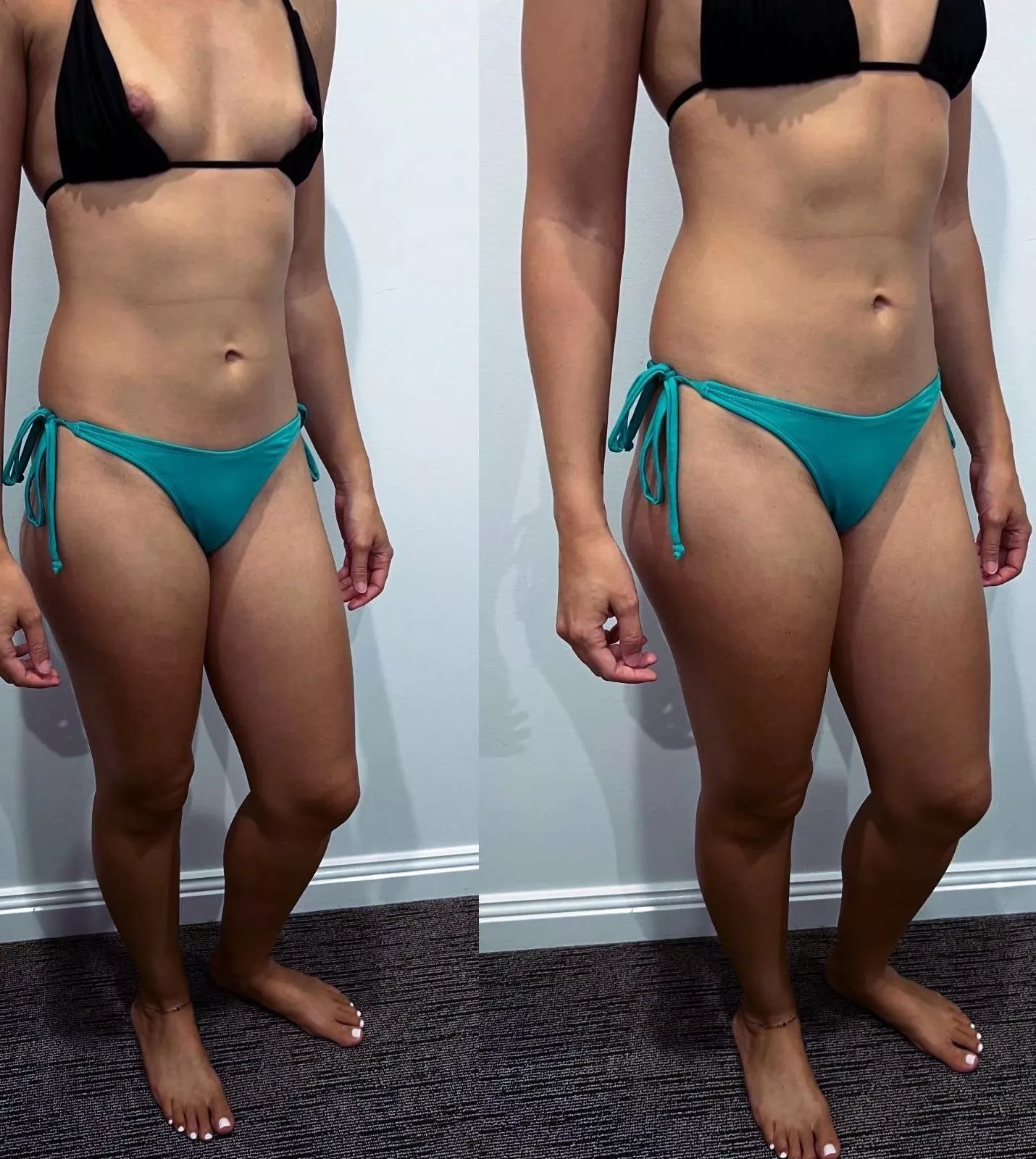 These keep falling out i am not sure i can go to the beach posted by scientist_hotwife