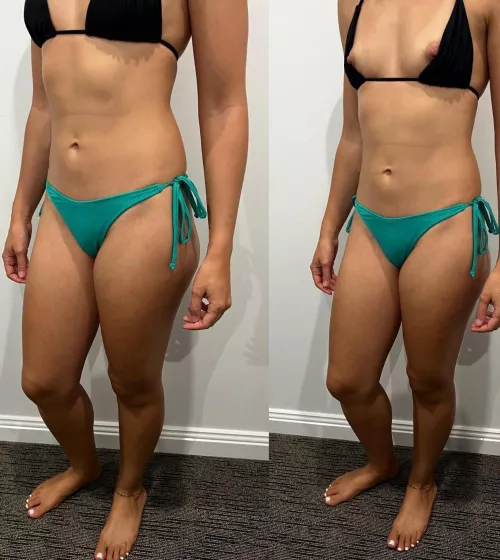 I like when they fall off so you can use your tongue instead of sunscree by scientist_hotwife