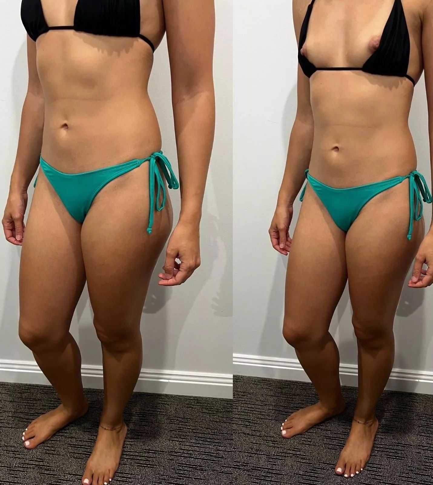 I like when they fall off so you can use your tongue instead of sunscree posted by scientist_hotwife