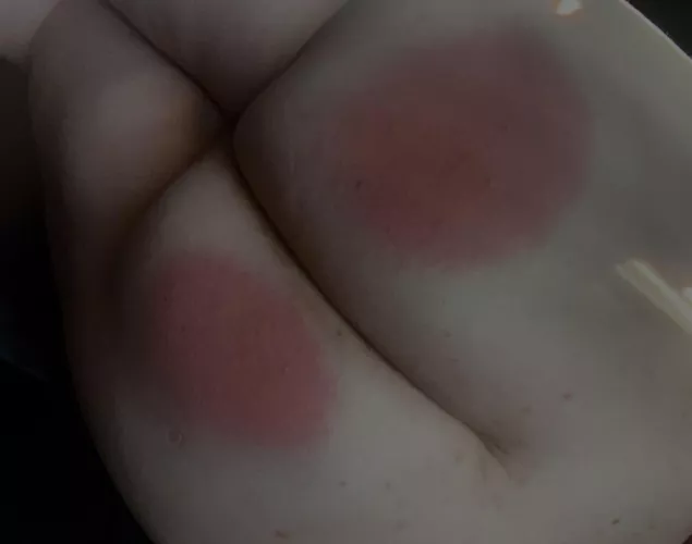 I need someone to had some lines and welts to my red bottom by Slutty_turtle04