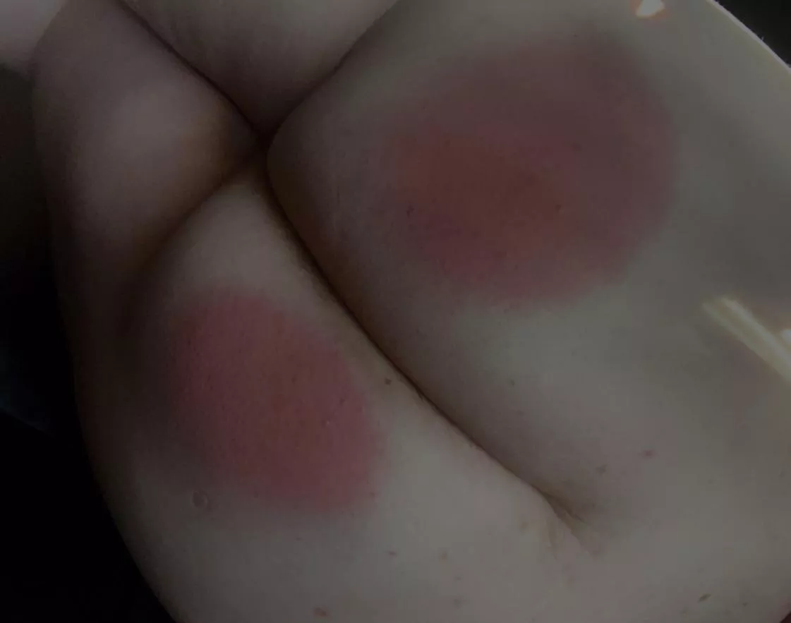 I need someone to had some lines and welts to my red bottom posted by Slutty_turtle04
