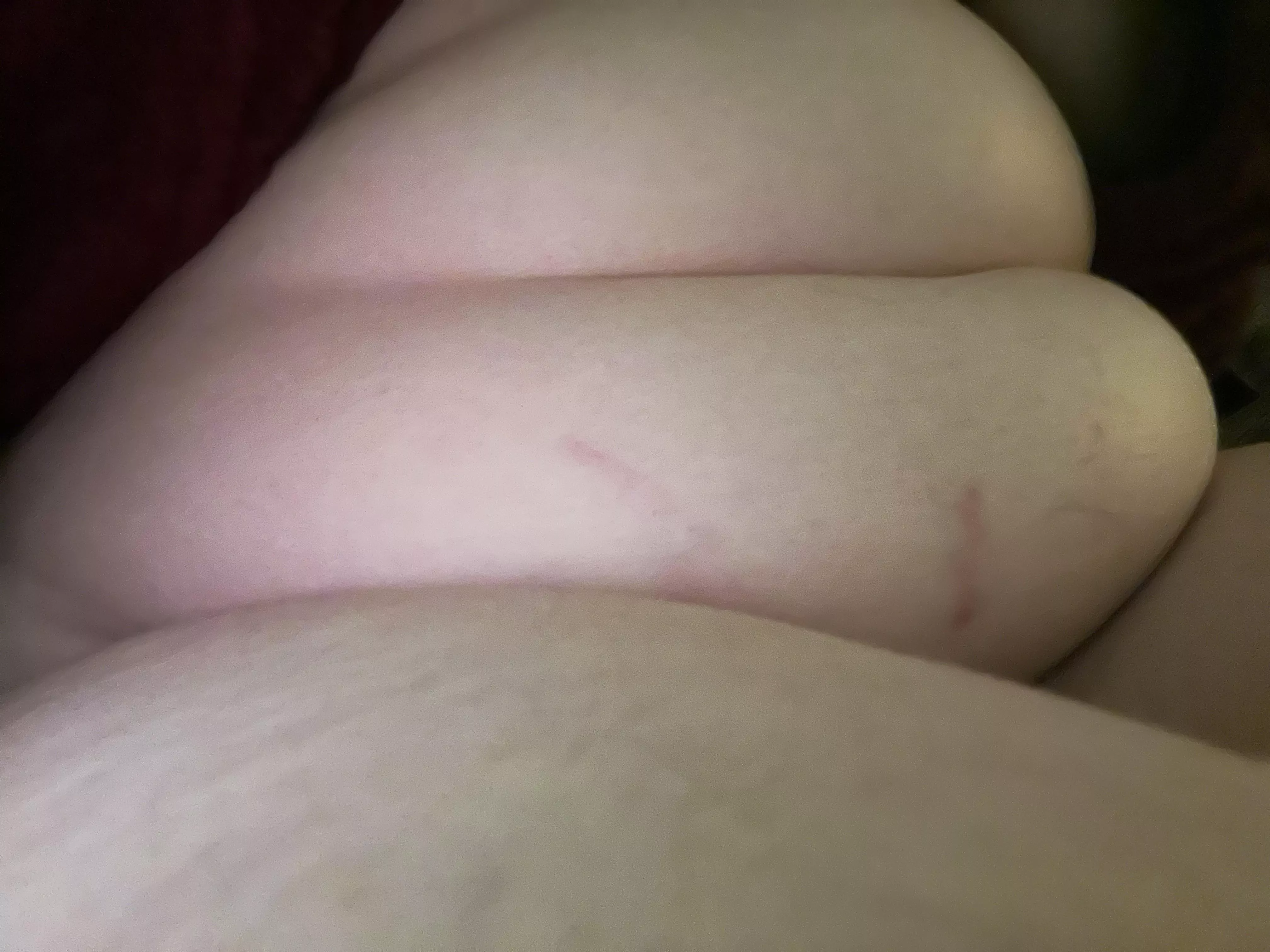 my cellulite ❤️ posted by thatempress