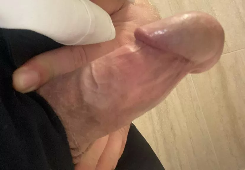 I don’t think I’m gonna last much longer in NNN!! posted by Anonymously7689