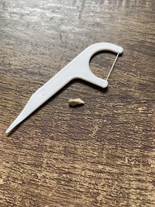 Removed this calcium buildup from behind a bottom, front tooth. by DaftFunk11