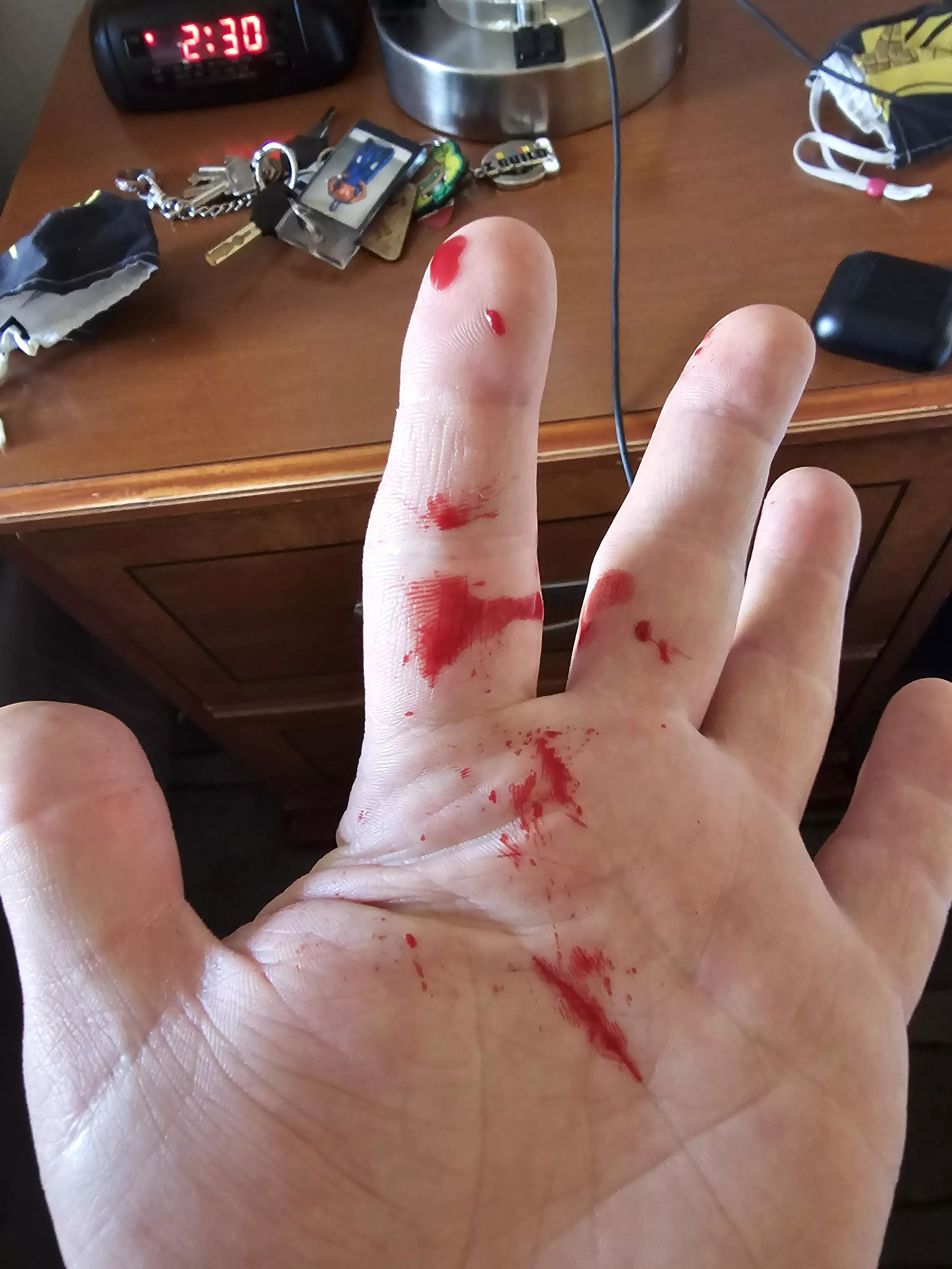 Had an absolute gusher on my thigh today posted by Smaptimania