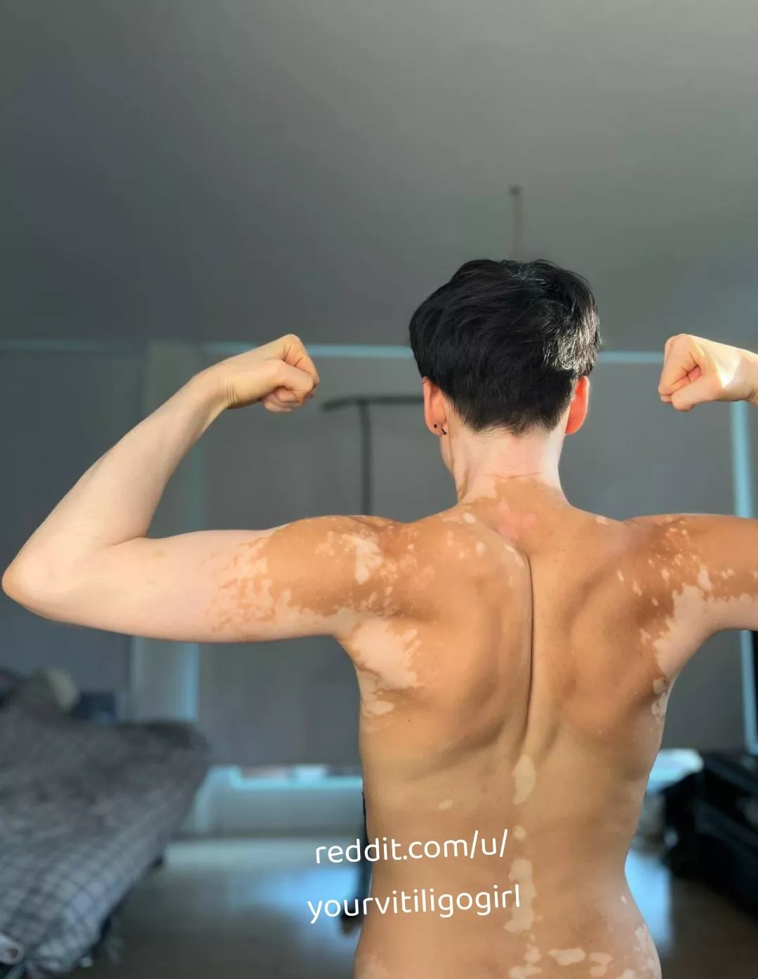 Flexing post workout (f) posted by yourvitiligogirl