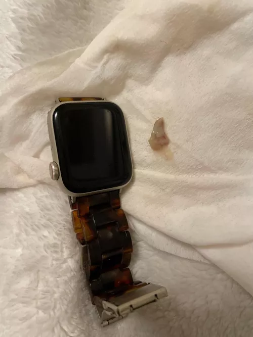 Sinus pop- Apple watch for scale by momthom427