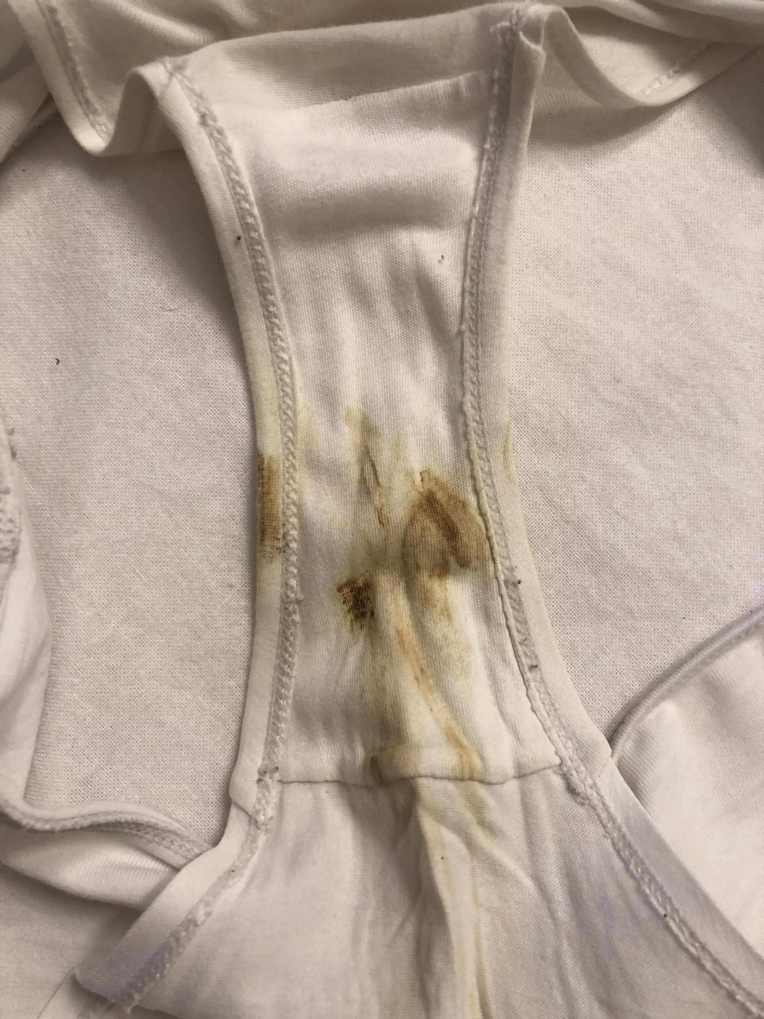 Do you like my gusset after 3 days (close up pic) posted by EnvironmentalLow622