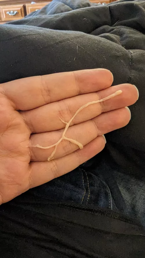 Being sick is so much fun! by TheDandyLion7