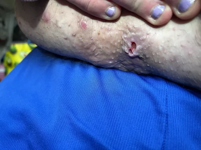 Nasty thing under stomach by dangriff88