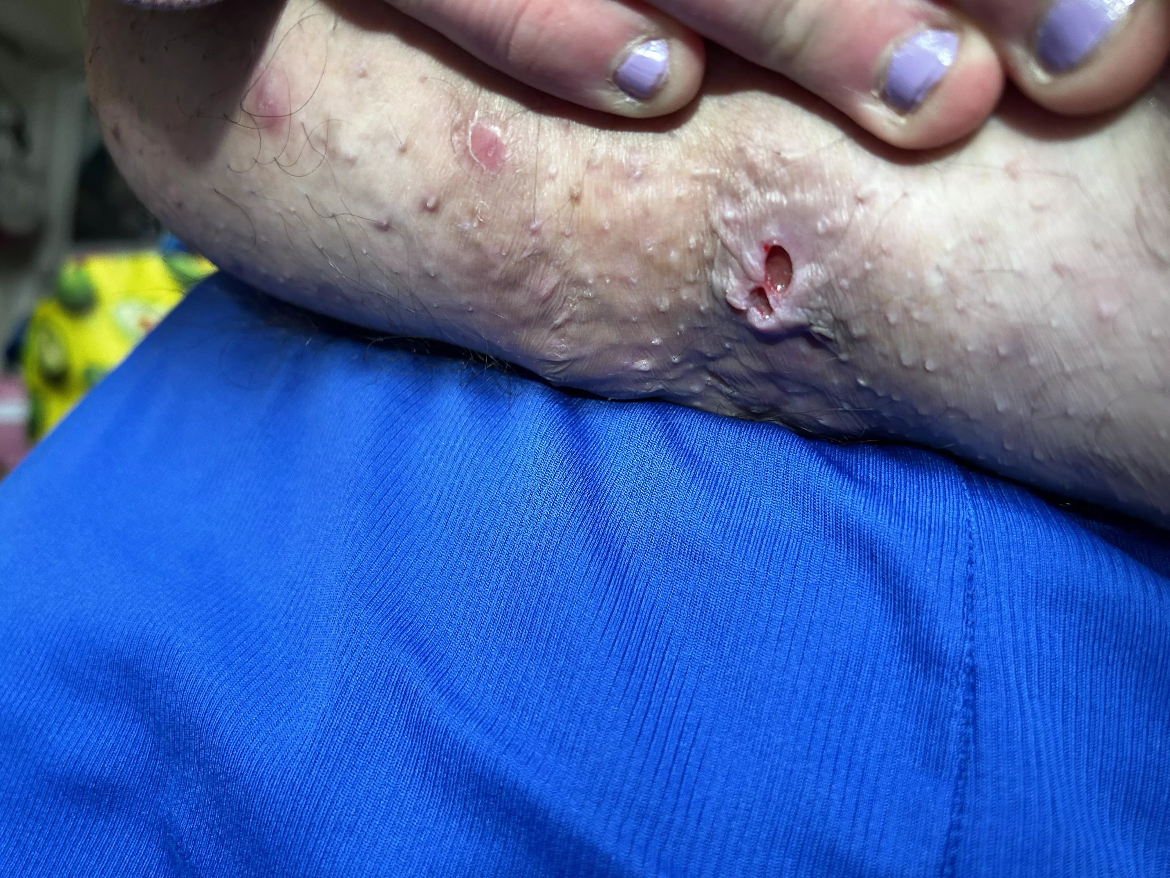 Nasty thing under stomach posted by dangriff88