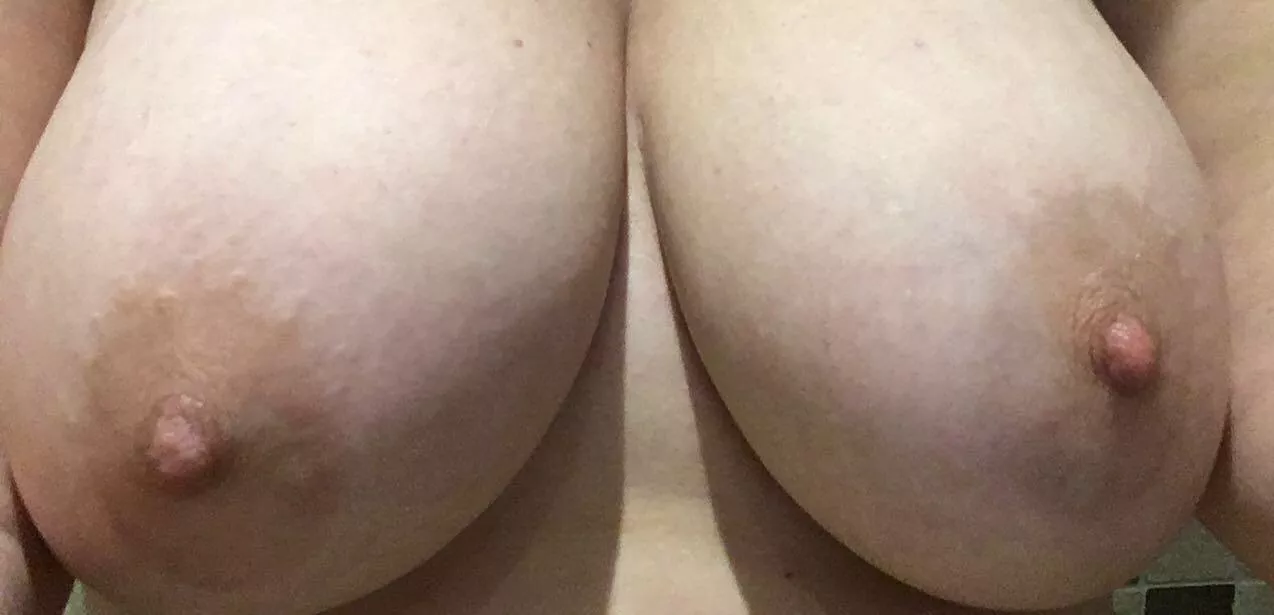 They might need some attention :) posted by hotc7